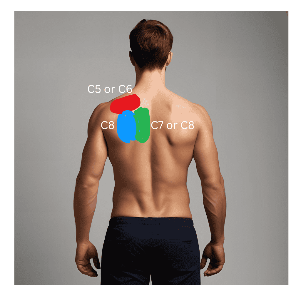 Scapular pain of cervical origin