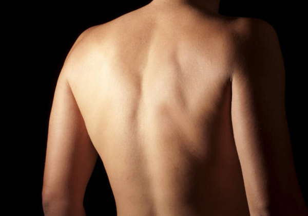 A person's lower back, assessed for low back pain at Farrelly Chiropractic in Narre Warren